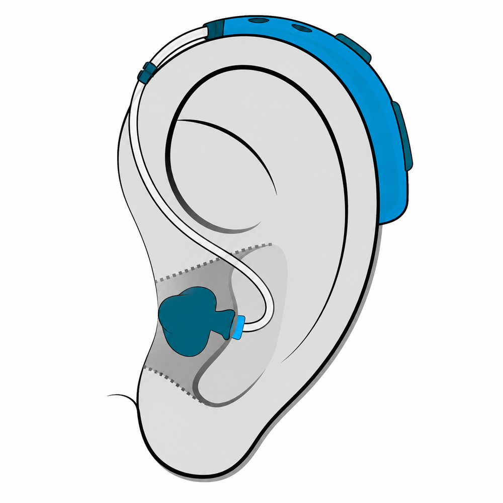 Behind-the-Ear (BTE) hearing aid style fitted at Hughes Holistic Audiology in Zionsville, IN