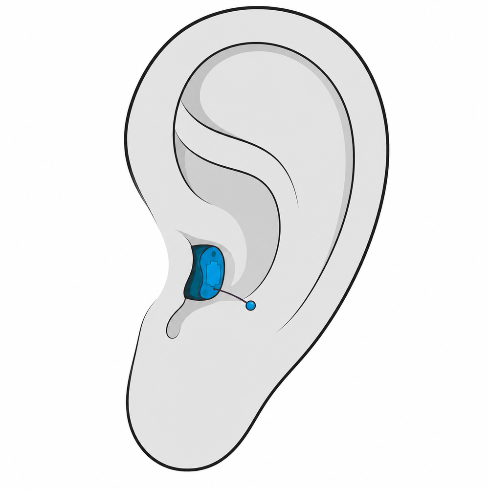 Completely-in-Canal (CIC) hearing aid style fitted at Hughes Holistic Audiology in Zionsville, IN