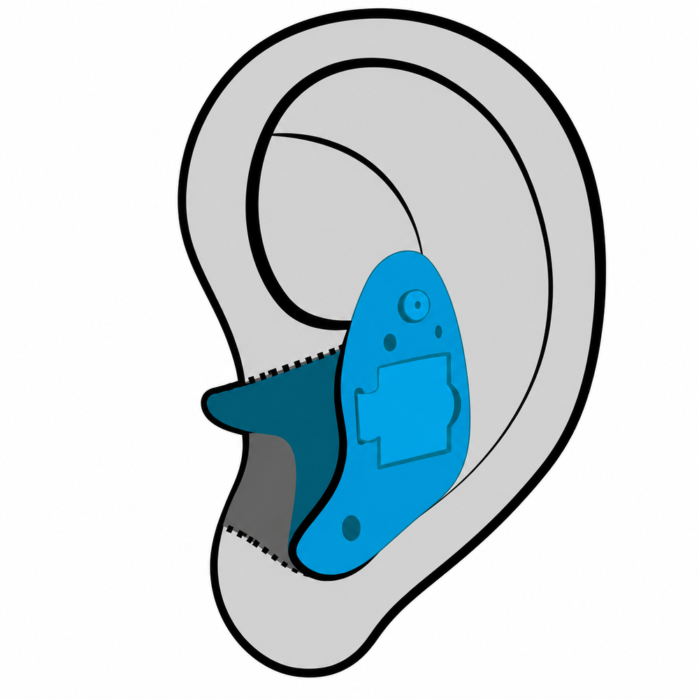 In-the-Ear (ITE) hearing aid style fitted at Hughes Holistic Audiology in Zionsville, IN