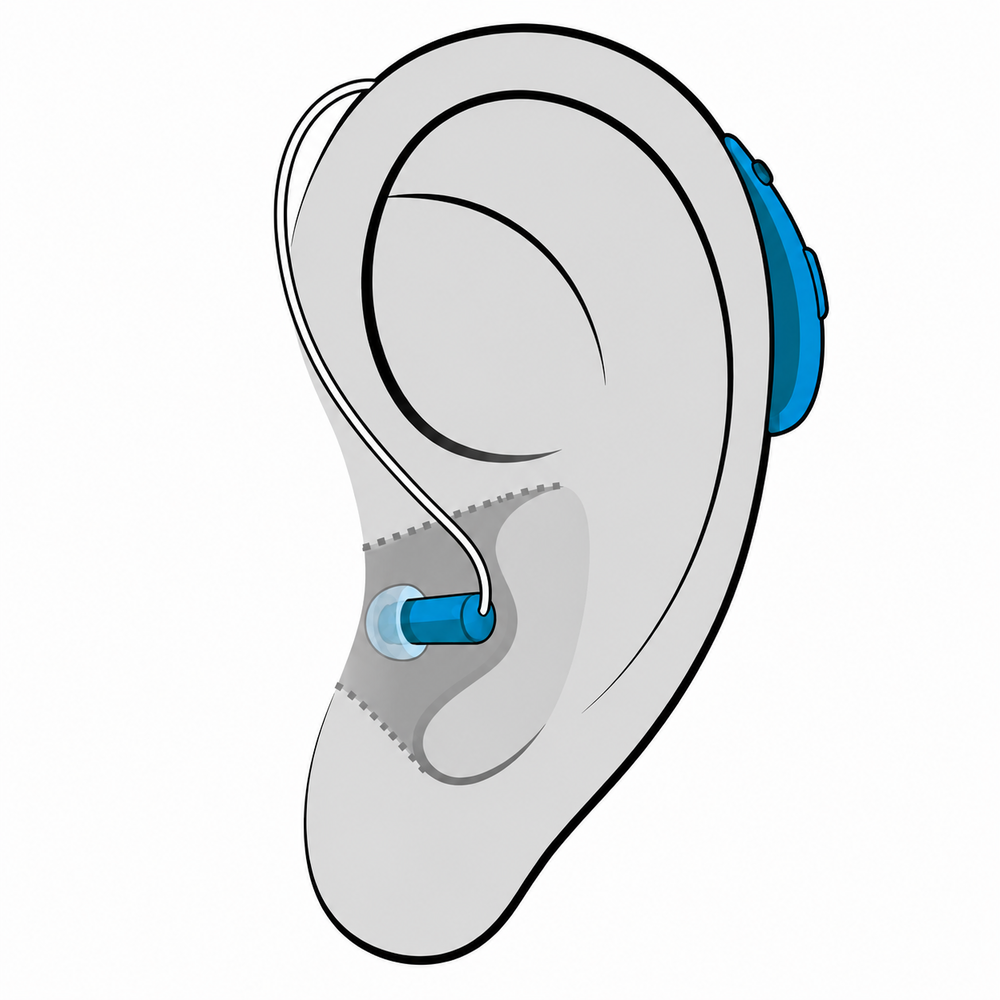 Receiver-in-Canal (RIC) hearing aid style fitted at Hughes Holistic Audiology in Zionsville, IN